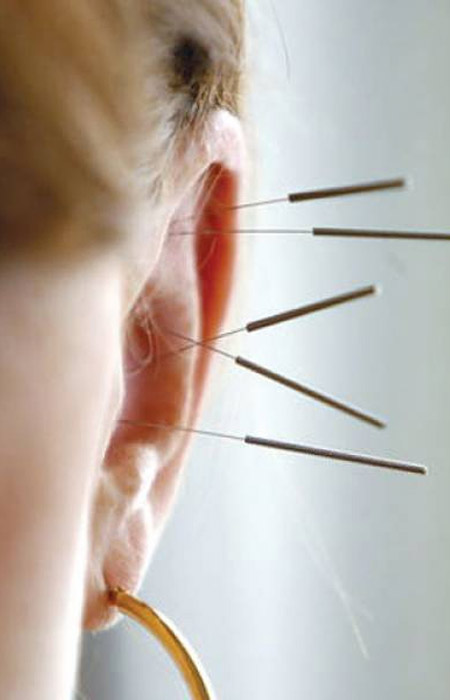 acupunucture for addictions in Vancouver