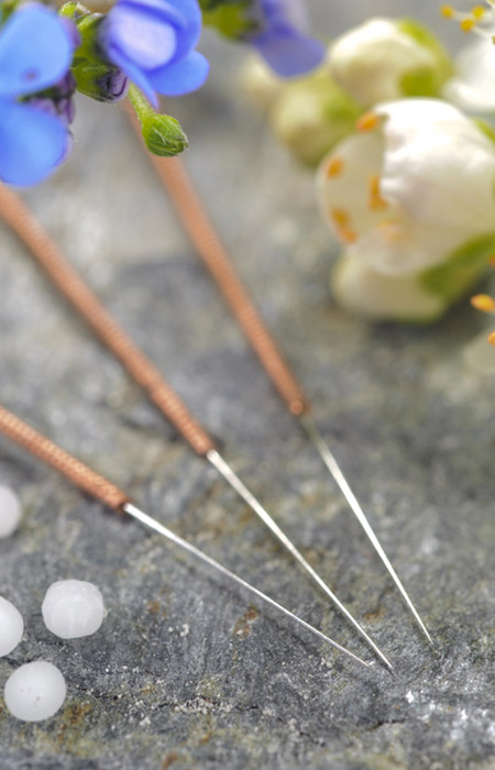 Acupuncture for Mental Health Issues in Vancouver